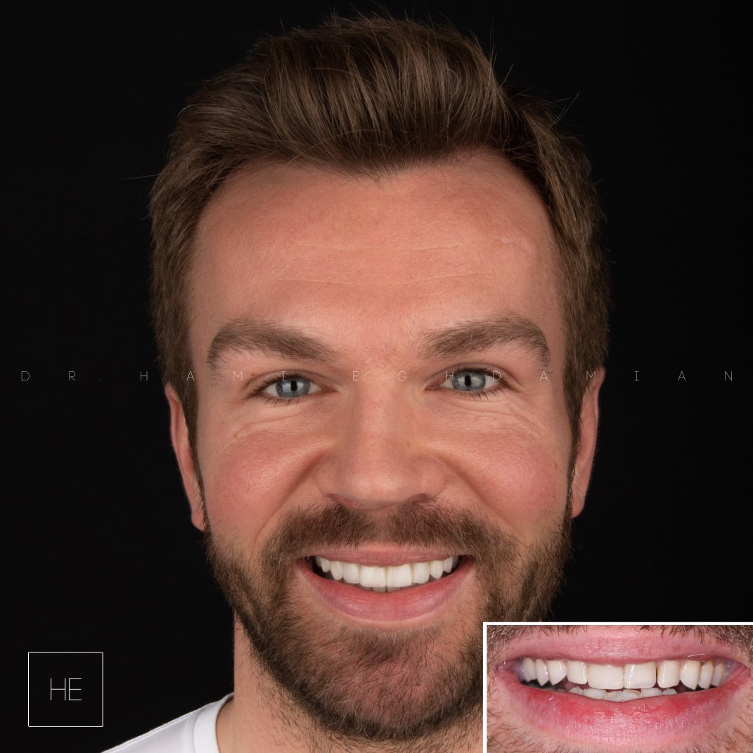 RH estetica dental marbella 